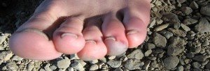 homeless-foot homeless-foot